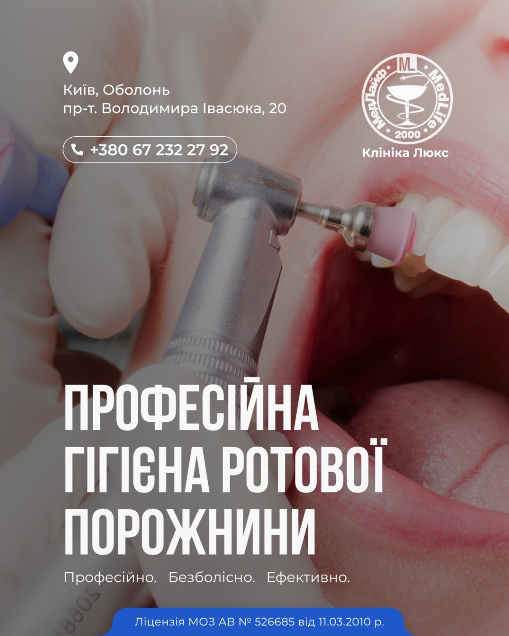 Професійна гігієна ротової порожнини